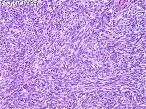 webpathology|pathology web.